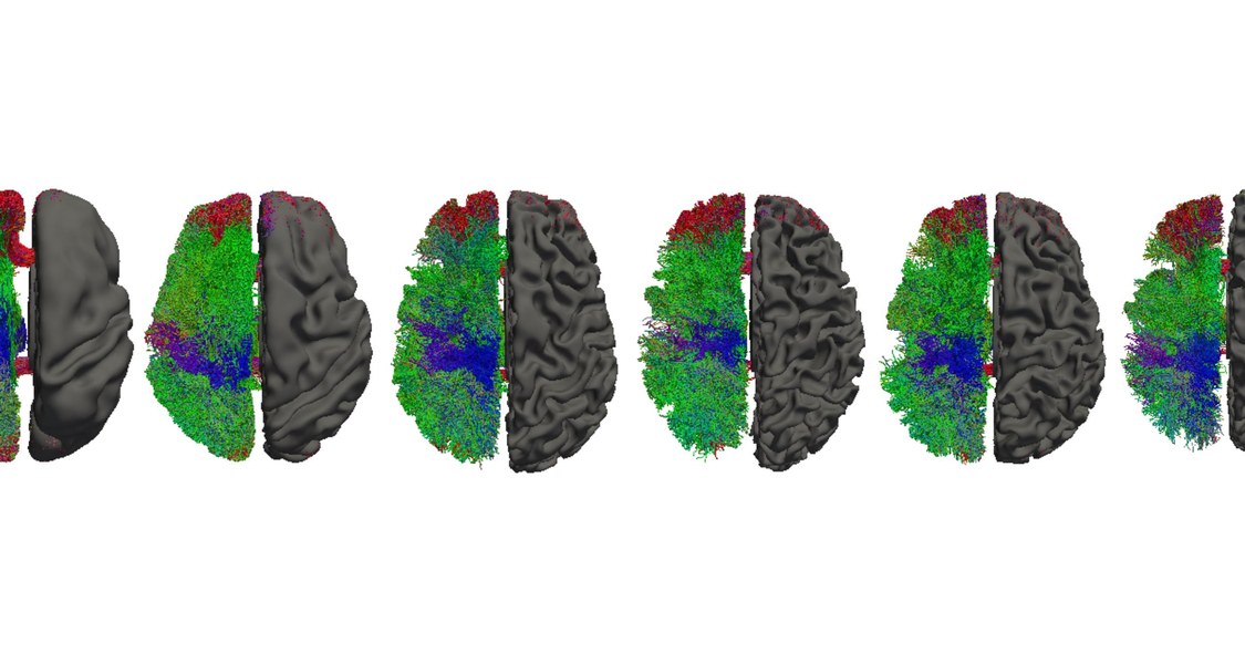 Mit Magnetresonanztomografie kann sichtbar gemacht werden, dass das Gehirn reift, wenn Säuglinge älter werden. (Abbildung: Stephanie Zika