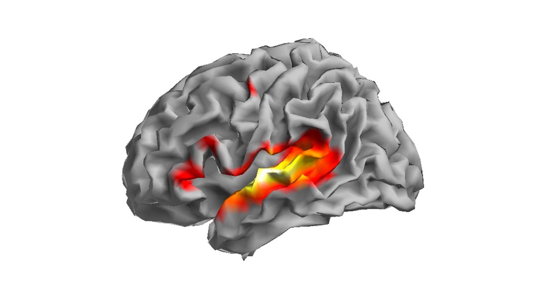 Copy of a brain scan