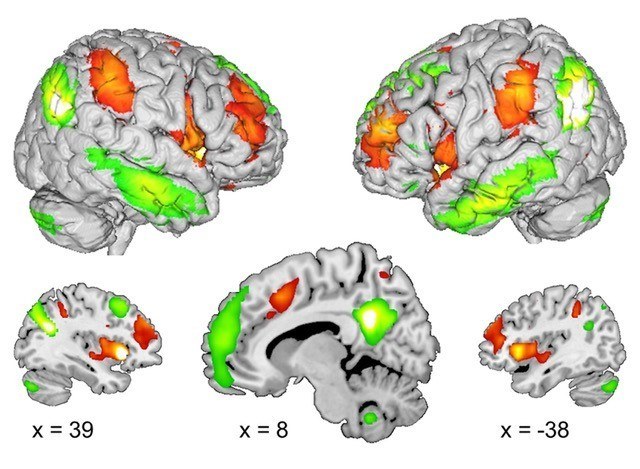 The diagram shows the brain regions associated with empathy (red) and perspective-taking (green).